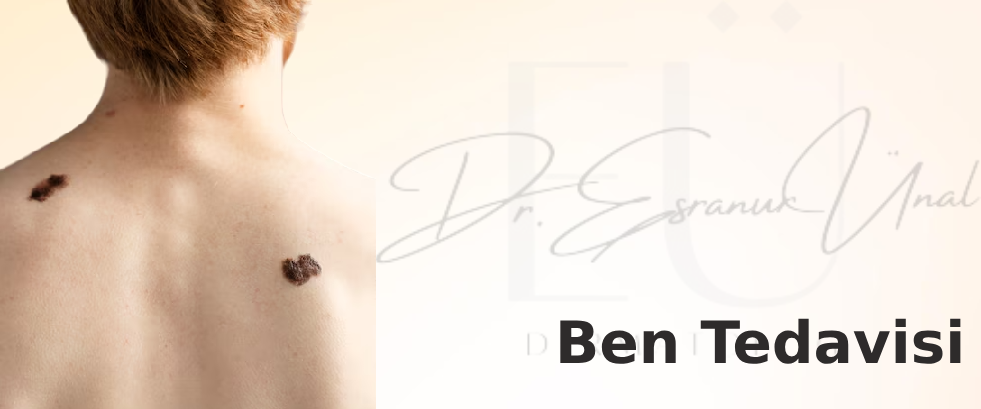 Ben Tedavisi Ben Tedavisi
