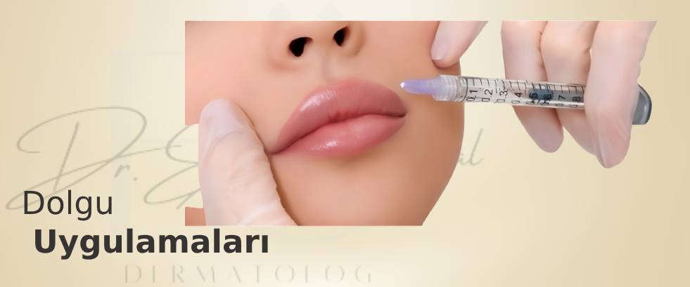 Dolgu Uygulamaları Dolgu Uygulamaları